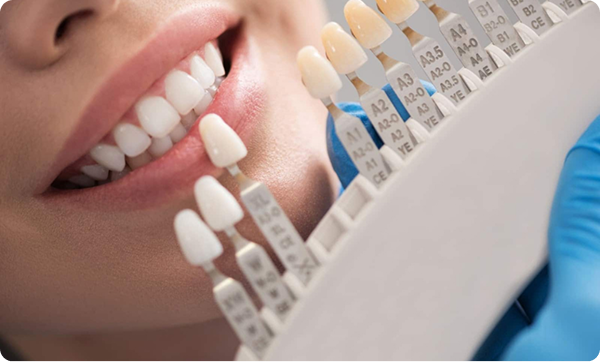 Des solutions durables pour restaurer votre sourire